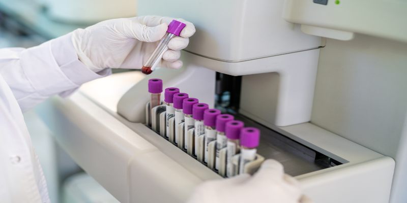 Primer plano de los guantes de un médico manipulando muestras de sangre en un laboratorio de pruebas.